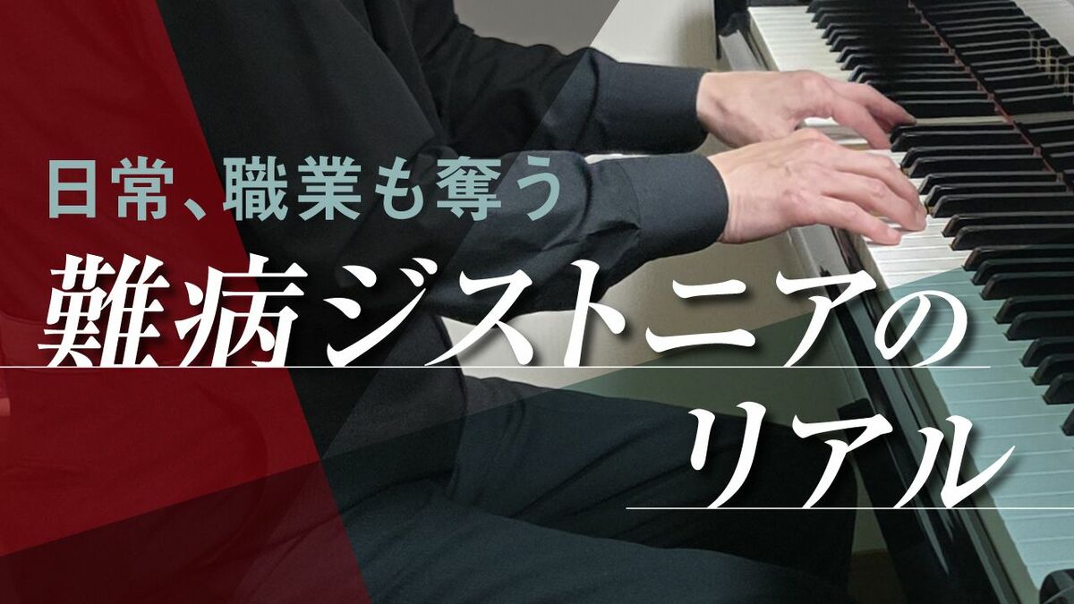 EVシフト加速で自動車業界が直面する部品調達の課題と日本企業の戦略