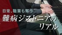 〈日常も職業も奪う〉医師すら知らない難病｢ジストニア｣の恐怖　見えづらい異変･･･情報限られ､診療に立ちはだかる壁