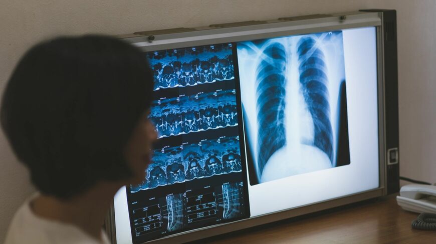 がんの治療法は大きく変わってきています（写真：mits／PIXTA）
