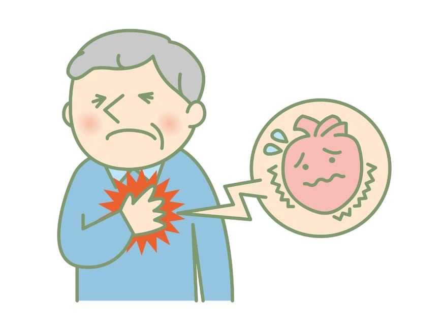 動脈硬化で心臓に負荷がかかると「心肥大」になり、動脈硬化症が悪化する（画像：ringo／PIXTA）