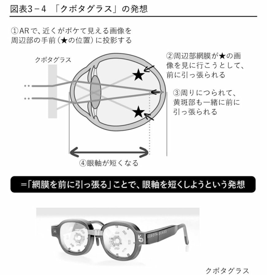 近視は病気です
