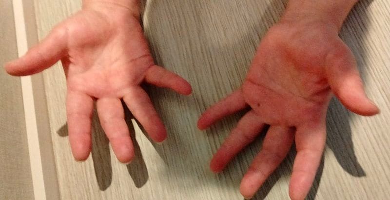 分厚く、がっしりした両手で大勢の人たちを施術してきたユウジさん。当時は皆が先生と慕ってくれたが、今はタイミーさん呼ばわり。「同じ私のはずなんですけどね」とうなだれる（写真：ユウジさん提供）