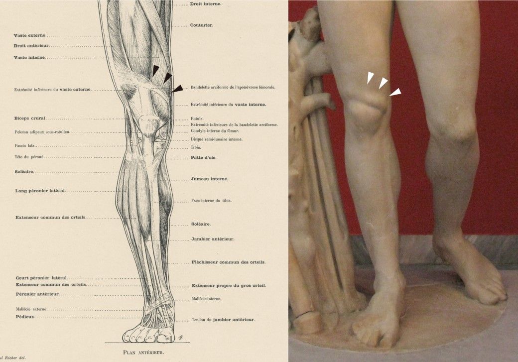 図3 膝上に溝を作る筋膜の図（左）と古代ギリシャ彫刻に表現された膝上の溝（右）。筆者撮影