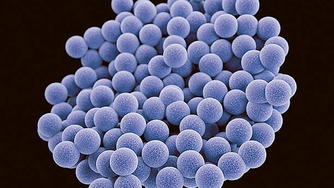 抗菌剤が効かない耐性菌の脅威