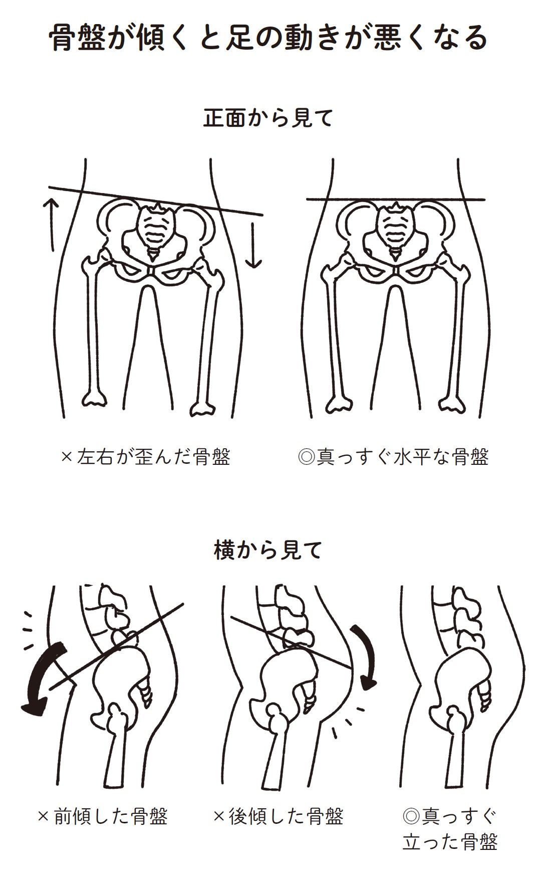 （出所：『外反母趾と足底腱膜炎 自力でできるリセット法』より）