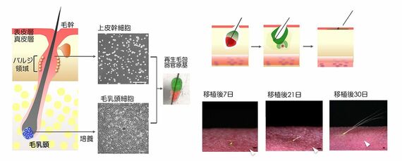 “毛髪のタネ”の作りかた