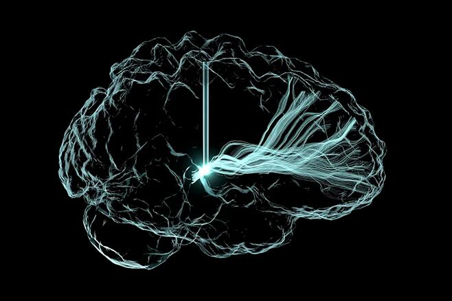 脳損傷の患者に｢脳インプラント｣という光明