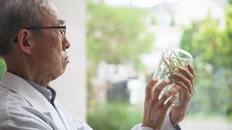 ｢軽度認知障害｣になって気づいた"観察の効能"