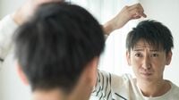 あいまいな薄毛情報に惑わされると危険なワケ 薄毛や脱毛には複数の種類と理由がある