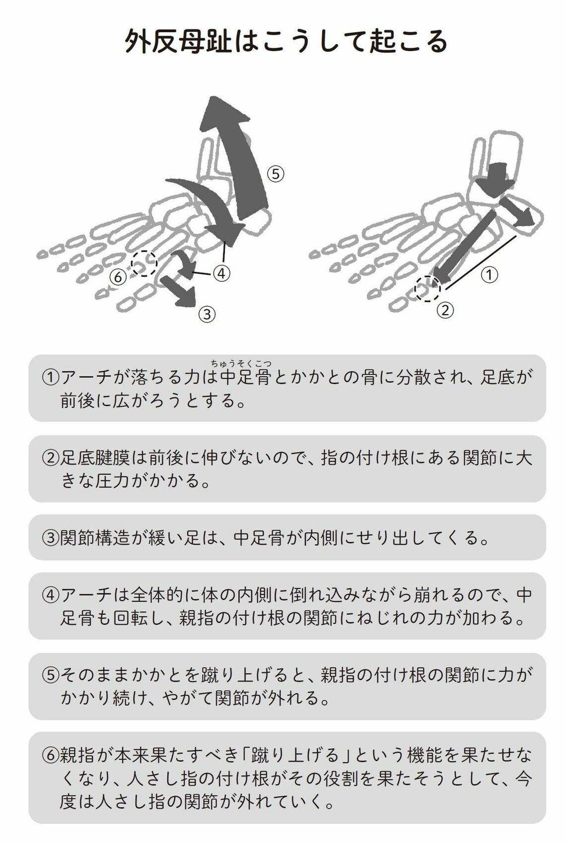 （出所：『外反母趾と足底腱膜炎 自力でできるリセット法』より）