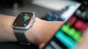 Apple Watchを使い始めてから健康への意識がガラリと変わった。心電図､睡眠､緊急通報──3つの機能が教えてくれたこと