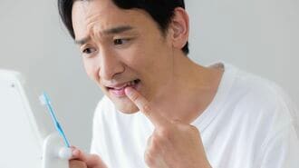 歯科医が警告「歯を損なう無意識習慣」の正体