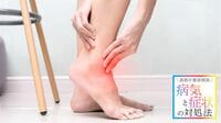 【捻挫】実は勘違いも多い！湿布の正しい使い方 足首のひねり｢クセになりやすい人｣の特徴は？