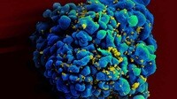 医学界に衝撃！治療なしで｢HIV完治｣した女性 驚きの研究結果で患者の人生が変わる可能性