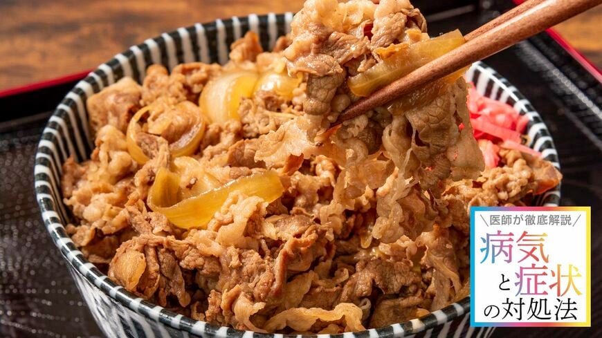 何も気にせず牛丼を食べる人に待ち受ける悲劇とは？（写真： genki／ PIXTA）