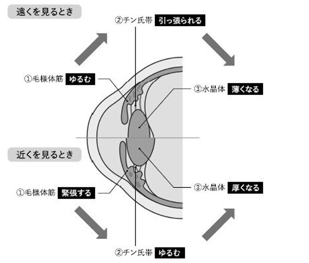 近視は病気です