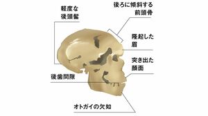 損傷を受けた脳は､いかに自己回復するのか 神経可塑性研究の最前線