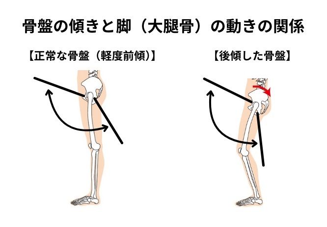 骨盤の傾きと脚の動きの関係（図：筆者作成）