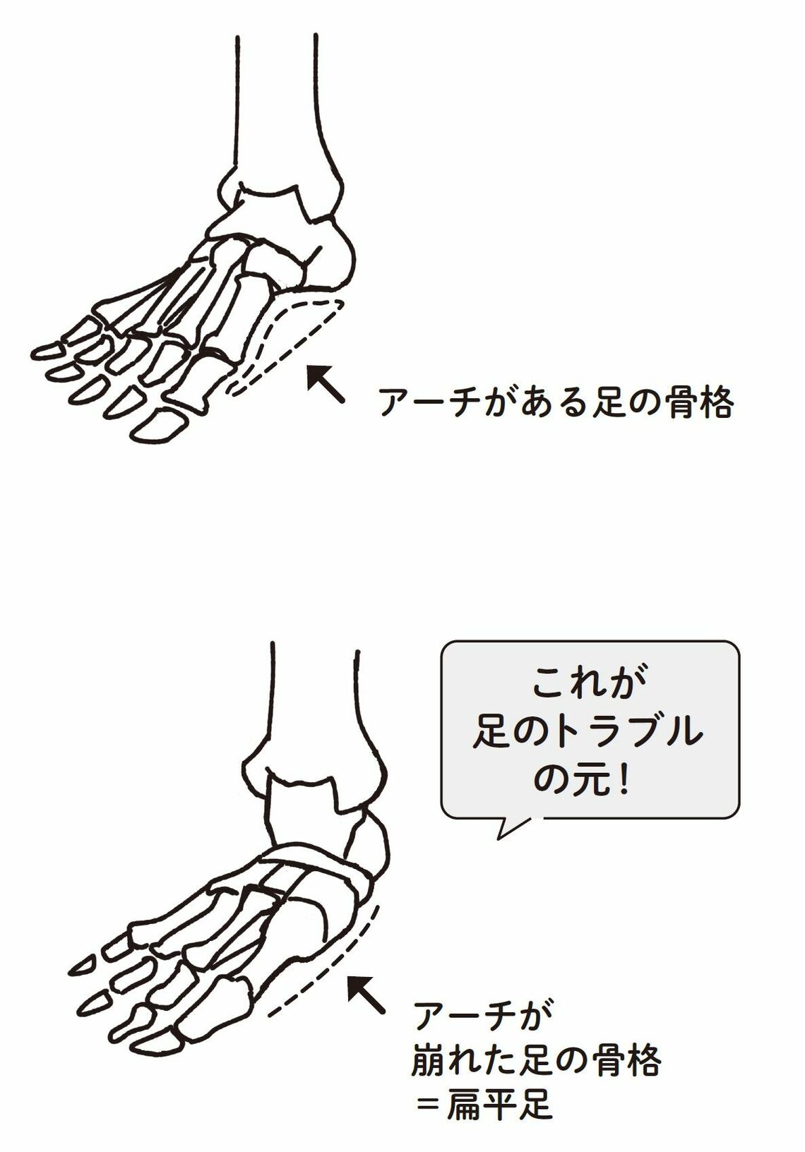 （出所：『外反母趾と足底腱膜炎 自力でできるリセット法』より）