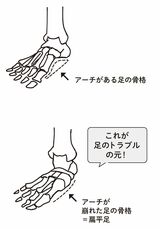 （出所：『外反母趾と足底腱膜炎 自力でできるリセット法』より）