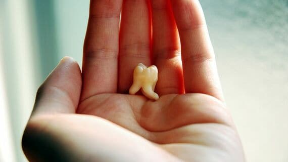 親知らずのイメージ