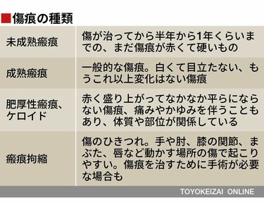 くっきり体に残る｢傷痕｣を治す最新ケアの超知識 帝王切開や手術ででき