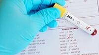 がんの血液検査には｢有害無益｣な項目がある ｢早期発見｣の声に流されず､賢い選択を！