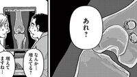 ｢大腿骨にカニが寄生｣　気味悪がった"中年患者"の境地　漫画｢まどいのいきもの ―銀河生物観察記―｣（第1集 第2話）