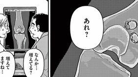 ｢大腿骨にカニが寄生｣　気味悪がった"中年患者"の境地　漫画｢まどいのいきもの ―銀河生物観察記―｣（第1集 第2話）