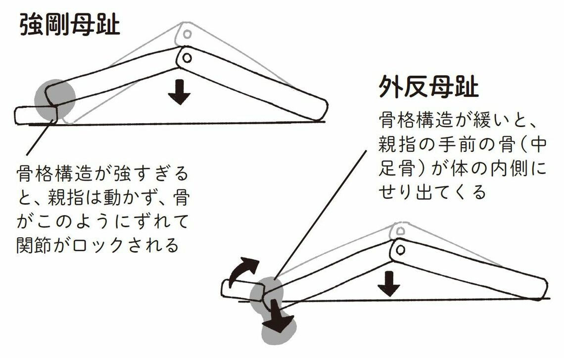 （出所：『外反母趾と足底腱膜炎 自力でできるリセット法』より）