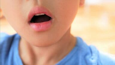 子どもの約4割が《お口ぽかん》､｢歯並び｣｢顔つき｣だけでなく｢学習面｣や｢高齢期｣にも悪影響が…放置は危険な深刻リスク