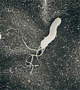 ヘリコバクター・ピロリ菌（写真：大塚製薬提供）