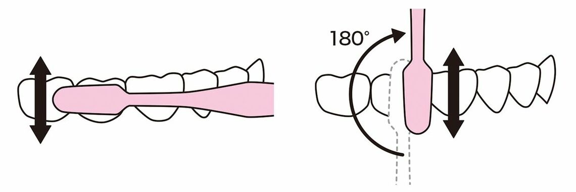 歯磨きの応用テクニック