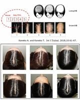 ルードヴィヒ分類・シンクレア分類とシンクレア分類