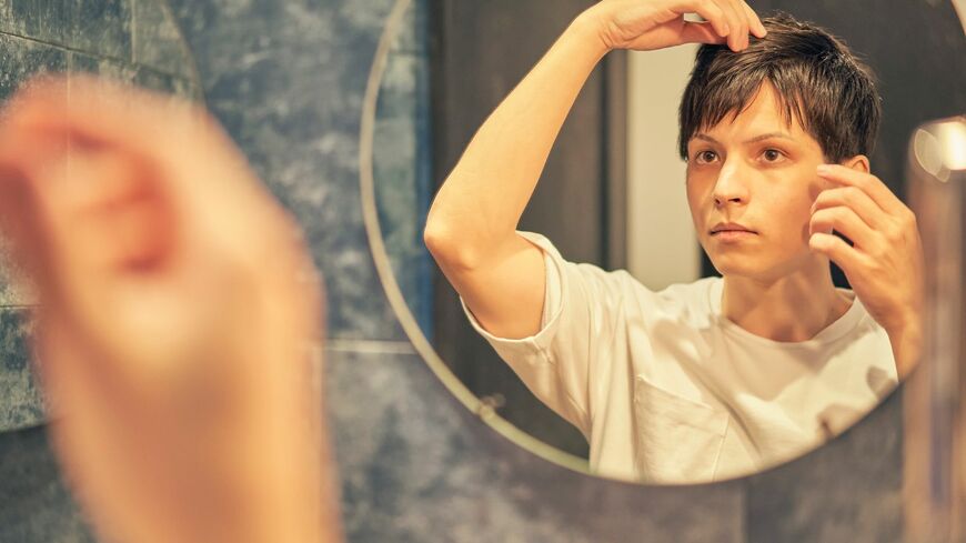 ちょっと薄毛が気になってきたという方に、スタイリングのコツをご紹介（写真：horiphoto／PIXTA）