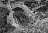 結核菌の電子顕微鏡写真（提供：公益財団法人結核予防会結核研究所）