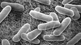 サルモネラ菌の顕微鏡写真。2023年度は食中毒の患者数が3年ぶりに増加に転じたという（写真：nishida／PIXTA）