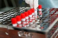 感染爆発止めた日本が｢安心｣と評価されない訳 コロナ検査なお脆弱､再拡大に備えられるのか