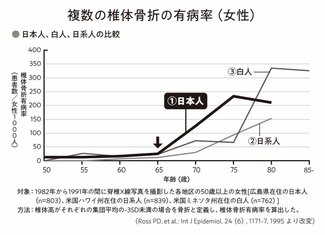 出所：『人は背中から老いていく 丸まった背中の改善が、「動ける体」のはじまり』より）