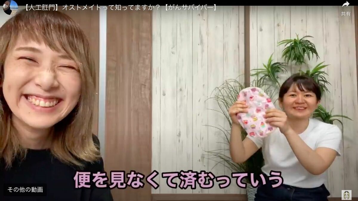 人工肛門造設術の実施方法