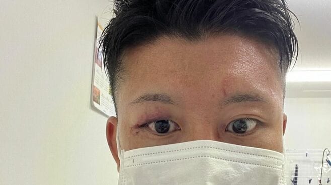 3カ月の勉強で医学部合格した格闘家のこれから