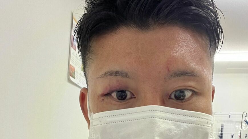救急医であり格闘家でもある岡田将人さん（写真：岡田さん提供）
