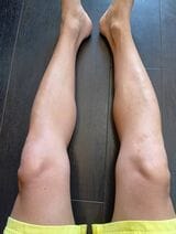 検証前の両足の状態（著者撮影）