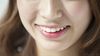 11年の歯科矯正が台なしになった女性の悲劇