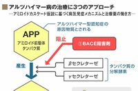 認知症の根本的な治療に｢3つの攻め手｣ 現状は症状改善薬しか存在しない