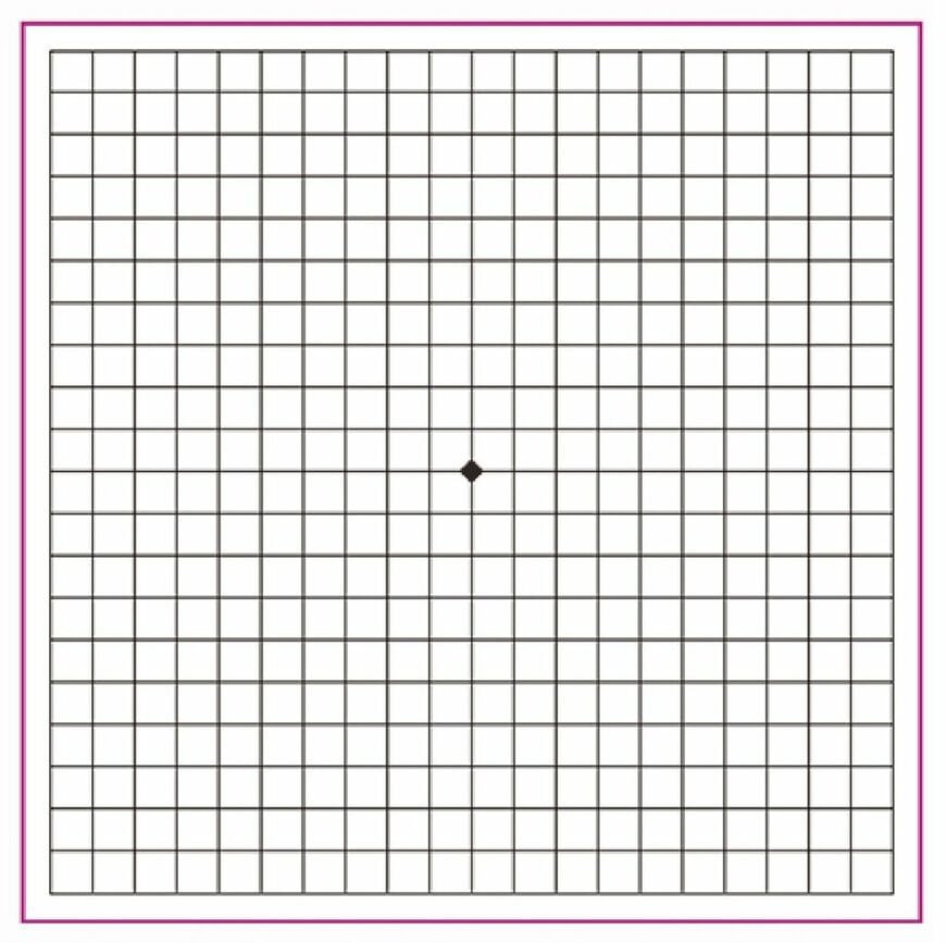 （図：「日本眼科啓発会議 アイフレイル啓発公式サイト」より）