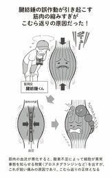 （出所：『足の名医がついにたどりついた こむら返りと手足のつりリセット法』より）