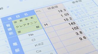 ｢腎臓数値が悪い｣ピンとこない人へ"放置の怖さ"