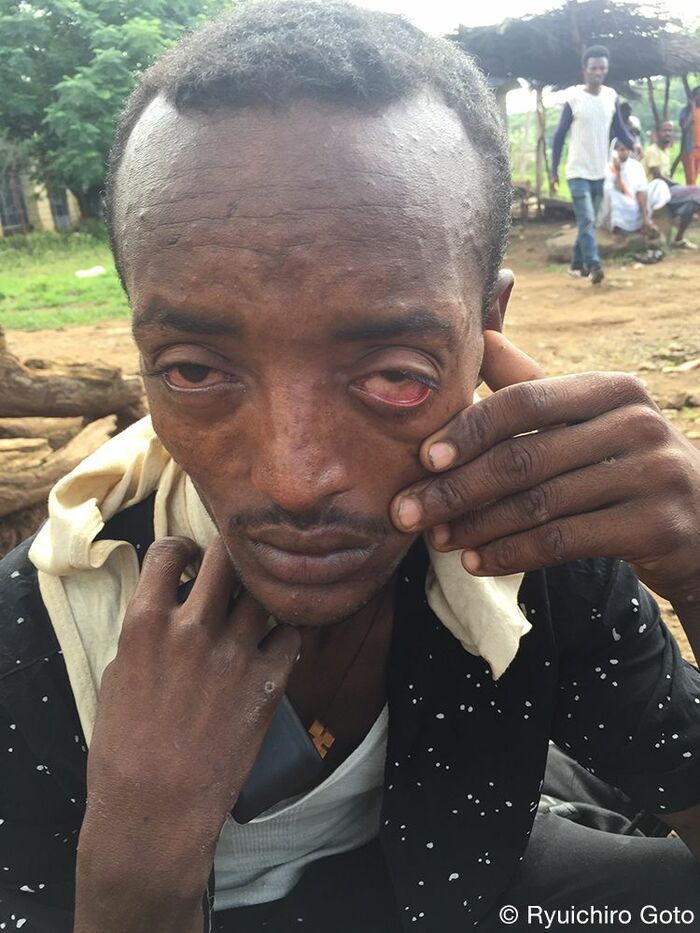 襲撃で怪我をした乗合バスの乗客―彼は軽傷