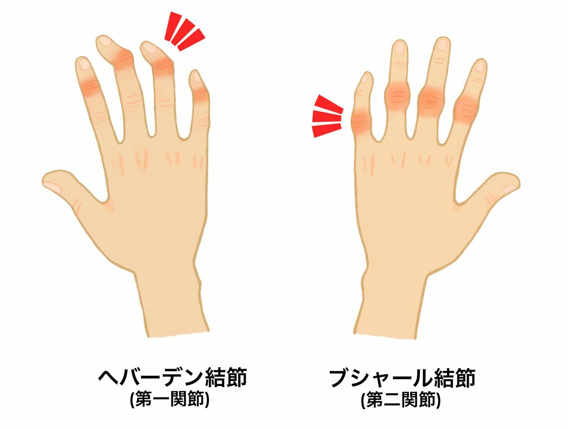 （画像：Mokooo／PIXTA）